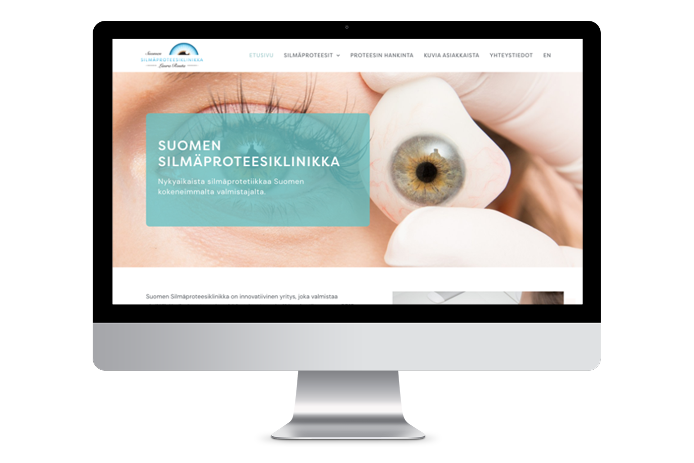 Kansikuva silmäproteesiklinikan verkkosivuista